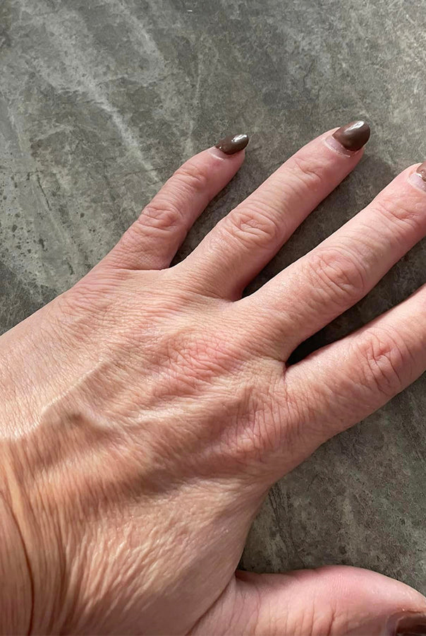 Image of Absoluter Andrea's hand, after taking Absolute Collagen's liquid collagen supplement