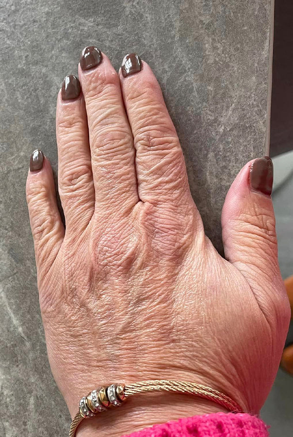 Image of Absoluter Andrea's hand, before taking Absolute Collagen's liquid collagen supplement