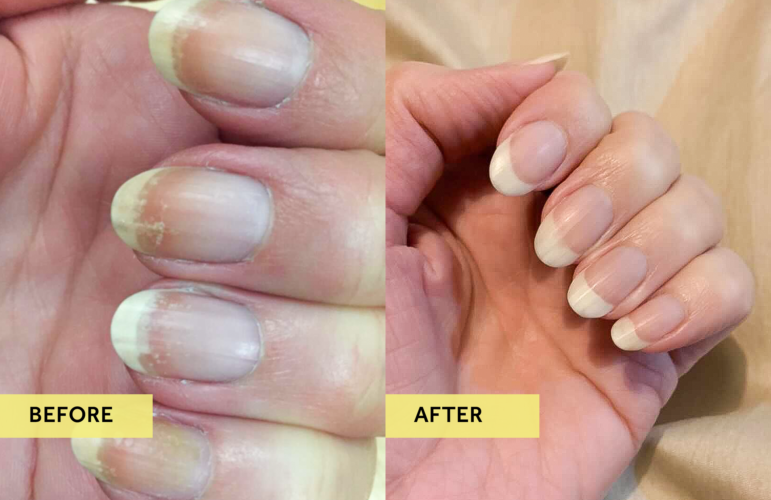 Collagen Benefits for Perfect Nails