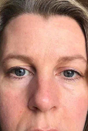 Image of Absoluter Kerrie after using Absolute Collagen's Collagen Supplement