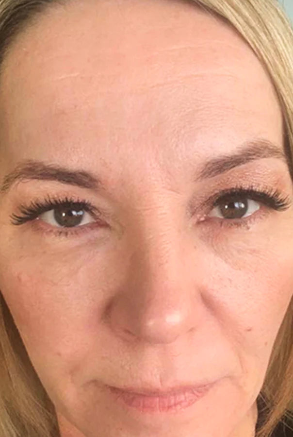 Image of Absoluter Lara after taking Absolute Collagen's Collagen Supplement