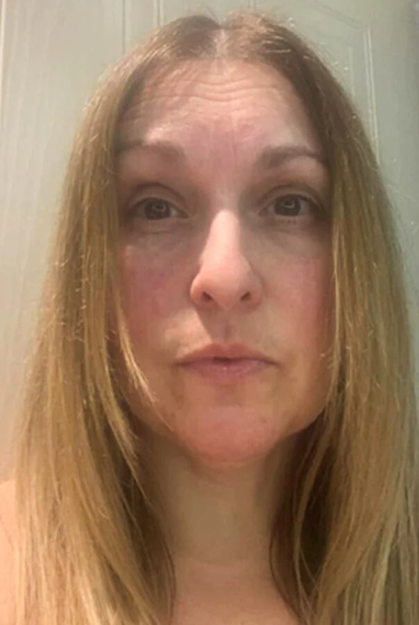 Image of Absoluter Sue after using Absolute Collagen's Collagen Supplement