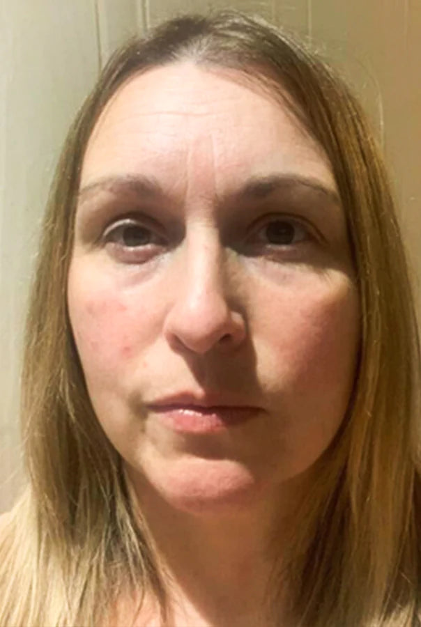 Image of Absoluter Sue before using Absolute Collagen's Collagen Supplement